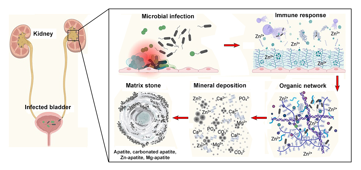 On the left is a cross-sectional drawing of a pair of kidneys connected to an infected bladder (indicated by bacteria drawn inside). An expanded callout from the right kidney depicts a series of events leading to the formation of a matrix stone, labeled as follows: Microbial infection, Immune response, Organic network, Mineral deposition, and Matrix stone formation.